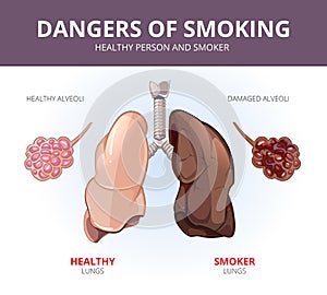 Lungs and alveoli of a healthy person smoker. Vector medical diagram