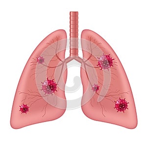 Lungs Human Internal Organ With Coronavirus Isolated White Background photo