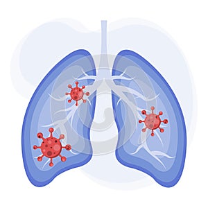 Lungs icon flat style. Human lungs with virus. Virus cells in lung, Infected lungs, Coronavirus, COVID-19. Vector illustration.