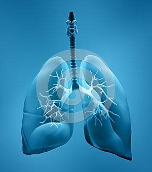 Lungs x-ray