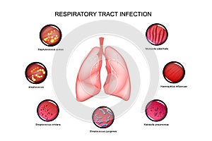 Lungs and respiratory tract infections