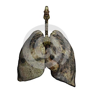 Lungs of Smokers