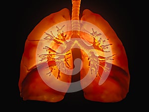 Lungs with visible bronchi