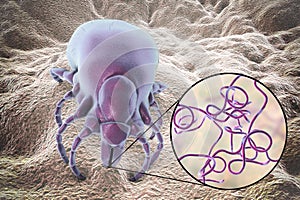 Lyme disease bacteria, Borrelia burgdorferi