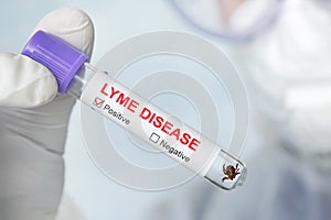 Lyme disease label on a test tube in the hands of a laboratory assistant. dangerous carrier of Lyme disease in glass vial in a