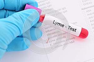 Lyme disease test