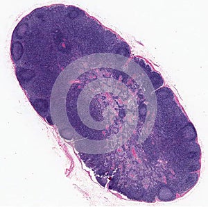 Lymph node