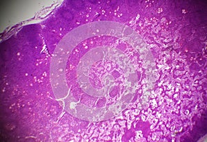 Lymph node section under the microscope