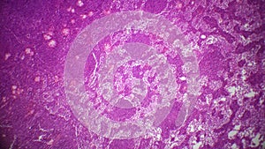 Lymph node section under the microscope