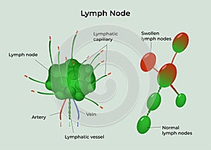 Lymph node System medical illustration