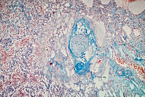 Lymph node tissue