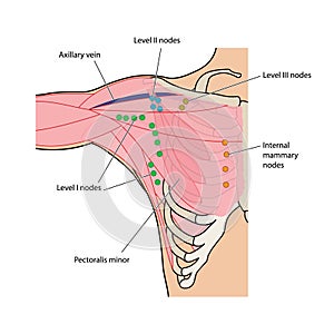 Lymph nodes of the chest and axilla photo