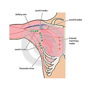 Linfa nodos de pecho a 