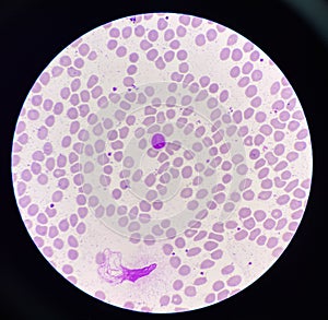 Lymphocyt WBC on red blood cell background