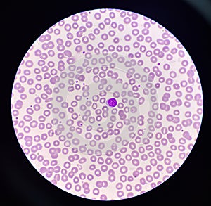 Lymphocyt WBC on red blood cell background