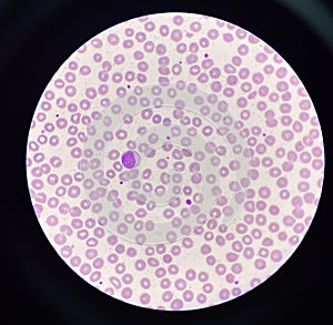 Lymphocyt WBC on red blood cell background