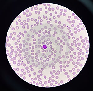 Lymphocyt WBC on red blood cell background