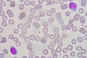 Lymphocyte