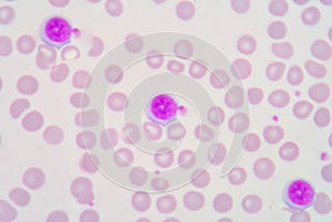 Lymphocyte