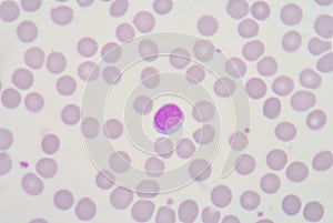 Lymphocyte