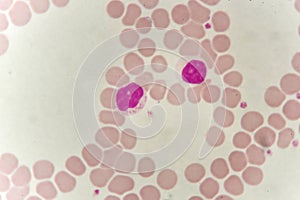 Lymphocyte cell in blood smear