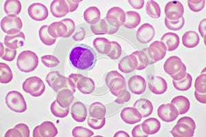 Lymphocyte cell in human blood smear