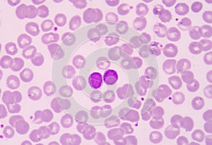 Lymphocyte. Immune cell. Antibody-producing cell. B-lymphocyte o