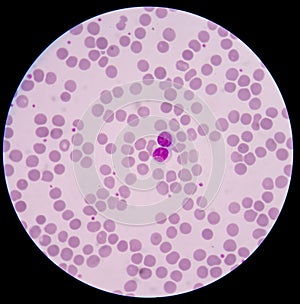 Lymphocyte on red blood cells background.