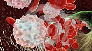 Lymphocytosis, illustration showing abundant white blood cells photo