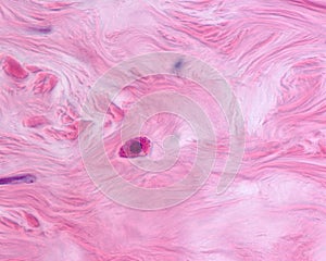 Connective tissue. Mast cell photo