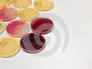 Mac Conkey agar in Petri dish, Selective isolation of Enterobacteriaceae and Escherichia coli. Isolate Gram-negative bacilli.