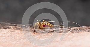 Macro of biting mosquito on the skin