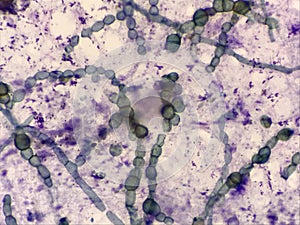 Macro budding yeast cells finding with microscope