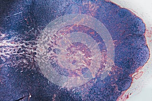 Macro cell- lymph node dog