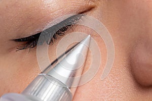 Macro close up detail of laser plasma pen reducing eye wrinkles photo