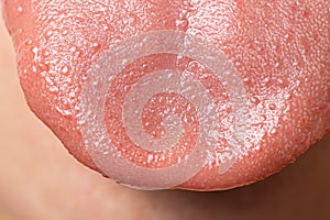 Macro close up surface of human tongue - sensory receptors of the papillae, tip of the tongue.