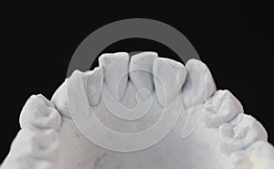 Macro close up view of plaster model of crowns of lower front teeth