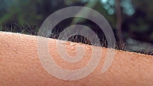 MACRO, DOF: Unknown person gets goosebumps during a cold tropical rainstorm.