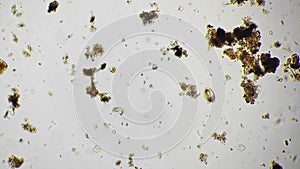 Macro footage of protozoa and group of infusoria moving in water taken for the analysis in the lab