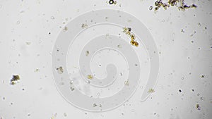 Macro footage of rotifer swimming and eating algae filmed under microscope against bright field