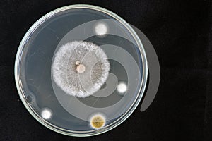 Macro of fungi on petri dish