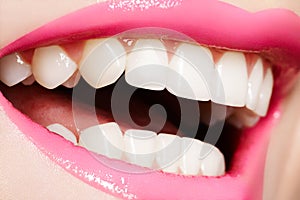 Makro šťastný žena úsměv zdravý bílé zuby 