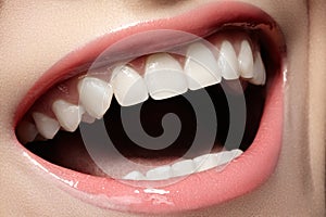 Macro happy female smile with healthy white teeth