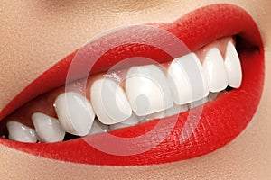 Macro happy woman's smile with healthy white teeth. Lips make-up
