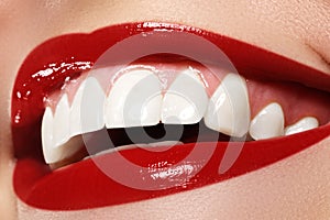 Macro happy woman's smile with healthy white teeth. Lips make-up.