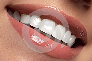 Macro happy woman's smile with healthy white teeth.Lips make-up.