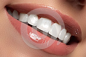 Macro happy woman`s smile with healthy white teeth.Lips make-up