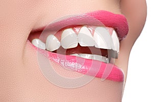 Macro happy woman`s smile with healthy white teeth, pink lips