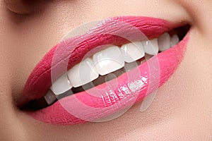 Macro happy woman`s smile with healthy white teeth, pink lips