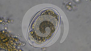 Macro Hookworm eggs parasite in stool examination